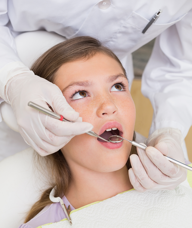 Dental Sealants