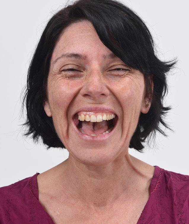 Tooth Extractions